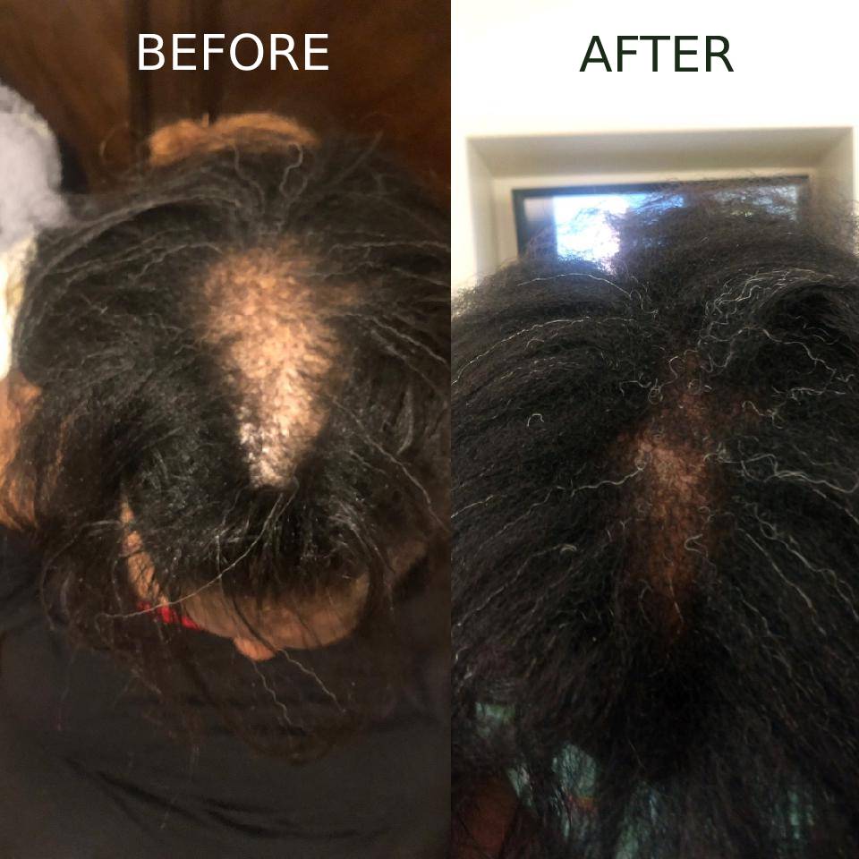 Hair Growth Oil